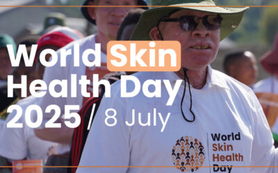 World Skin Health Day